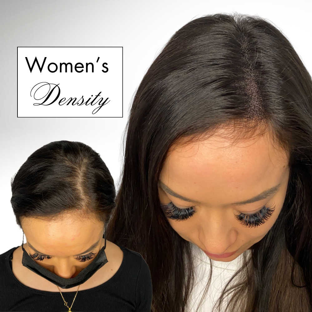 SMP for Women Hair Loss: Empowering Women with Confidence and Beauty