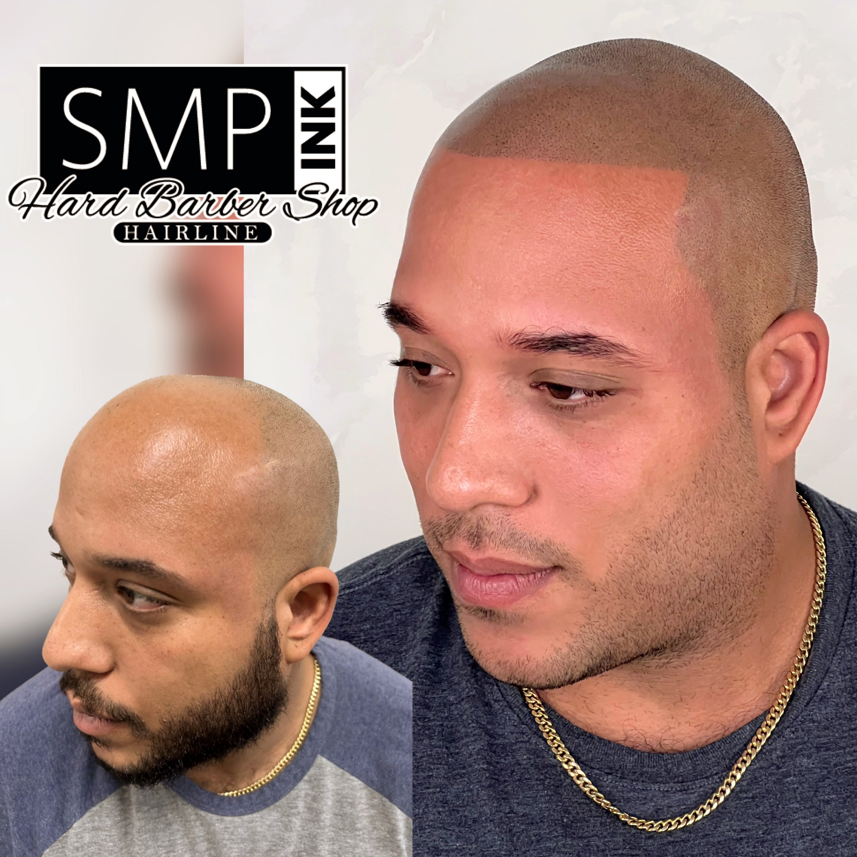 How Scalp Micropigmentation Can Restore Your Confidence