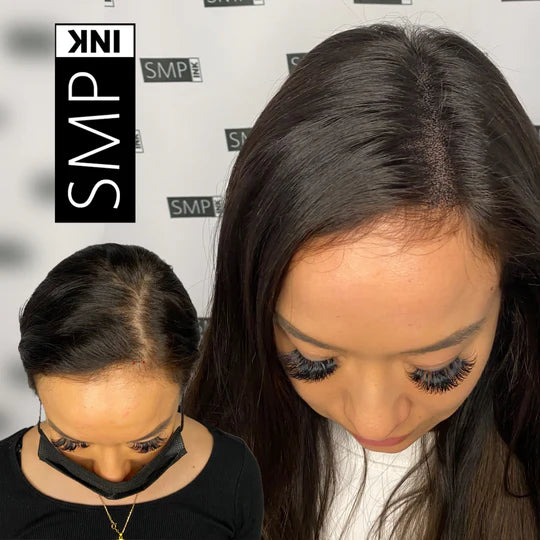 Women Scalp Micropigmentation Before and After