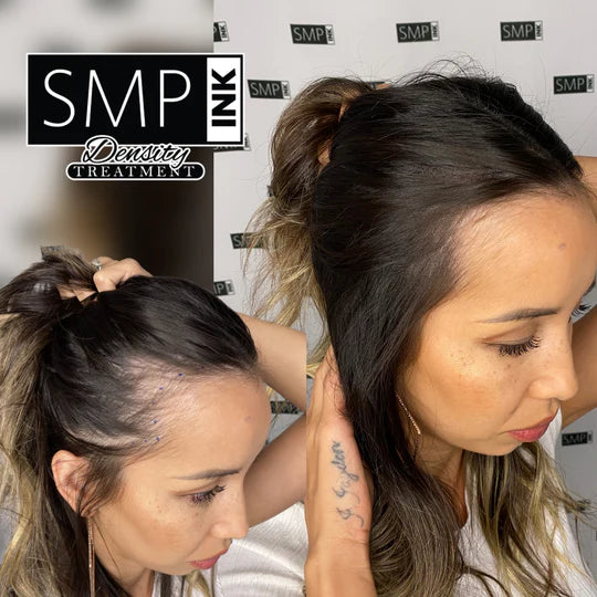 Women Scalp Micropigmentation Before and After 